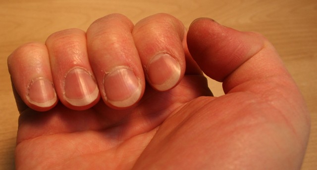fingernails pictures #11